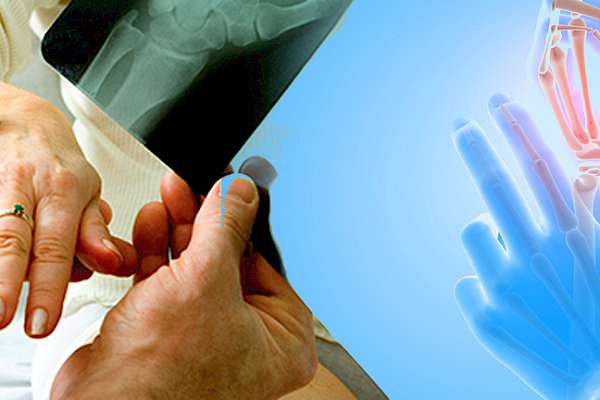Rheumatology
